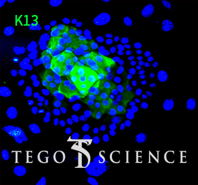 C-keratin-14/ DAPI