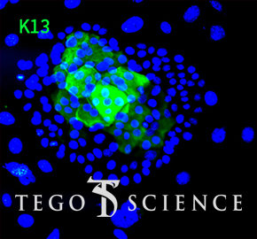 C-keratin-14/ DAPI